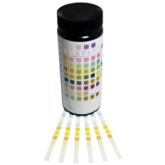 Urinalysis Urinalysis